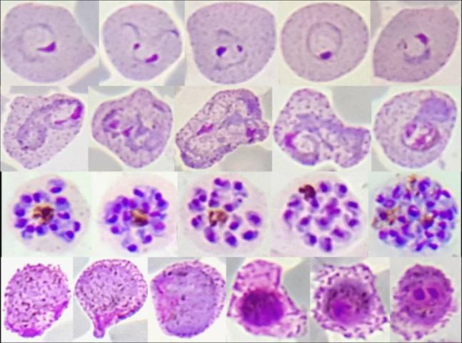 color atlas medical parasitology pdf